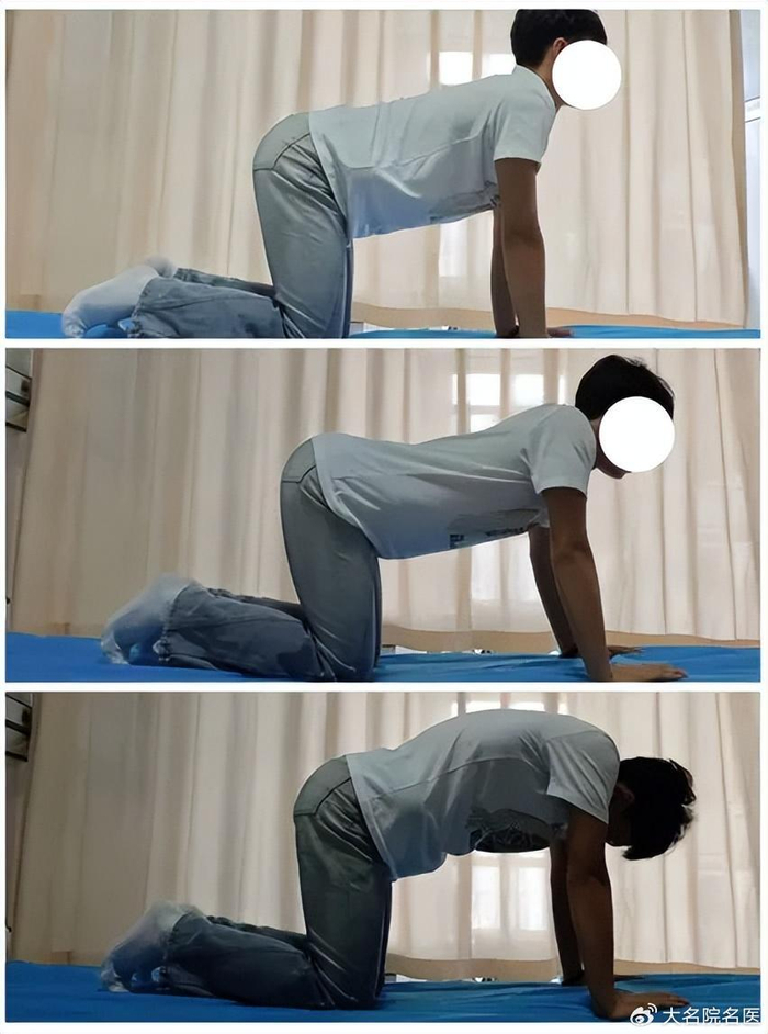 孩子脊柱侧弯怎么办?这么做让娃少走"弯"路