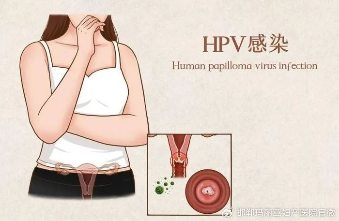 别担心,所有女生都必须知道的hpv知识|hpv|感染|宫颈癌_新浪新闻
