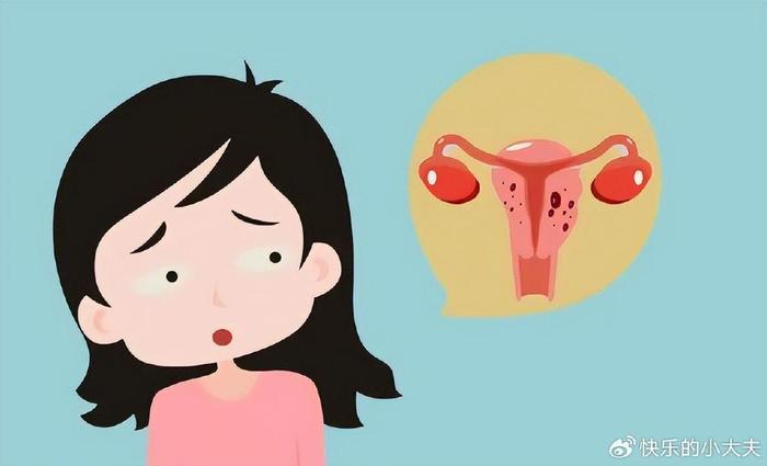 妇科第一瘤子宫肌瘤究竟是何方神圣出现哪些症状如何治疗