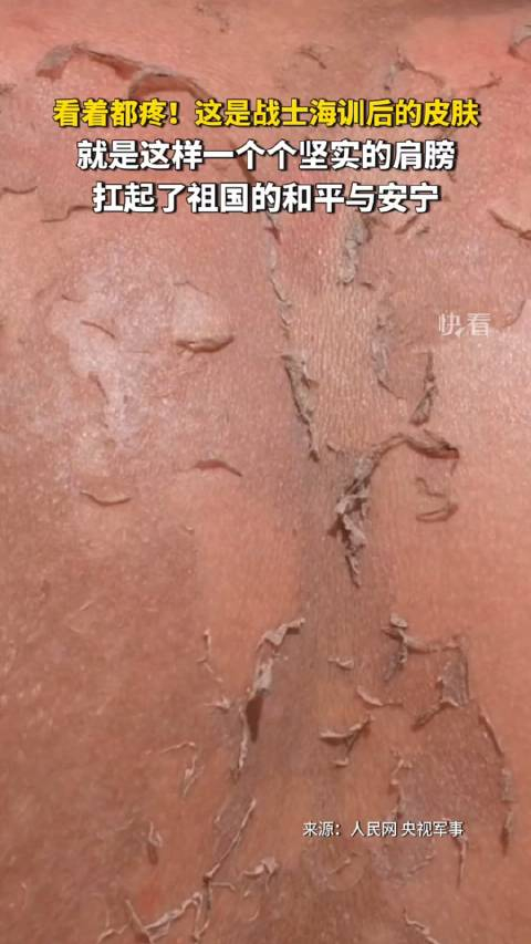 看着都疼!这是战士海训后的皮肤,就是这样一个个坚实的肩膀