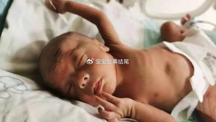早产婴儿不到2斤，一天花一万，家庭乱作一团