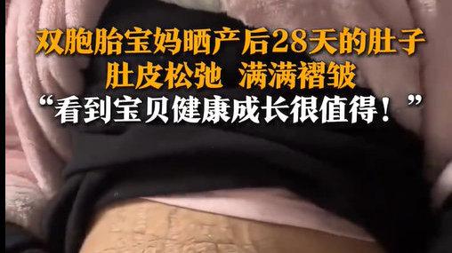 81斤双胞胎宝妈产后28天，肚皮褶皱书写母爱传奇与不屈精神