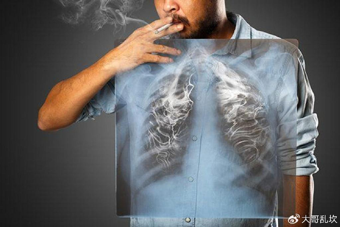 医生:若能控制在这个数,还算可以|肺癌|吸烟|香烟_新浪新闻