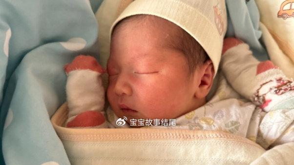 除了父母，这3个方面也影响宝宝颜值，不想宝宝丑要清楚