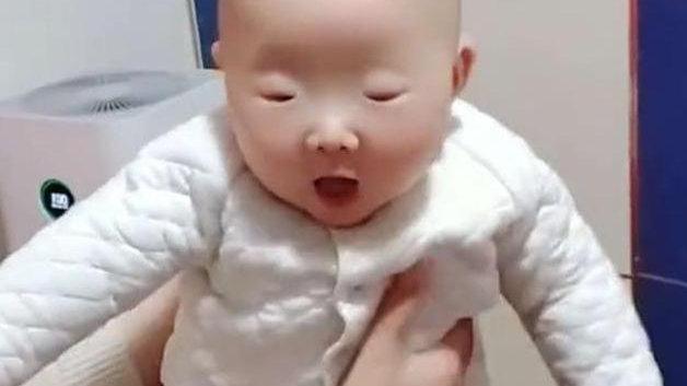 “最小眼睛宝宝”走红，这却不是父母所希望的，我们该怎么办呢？
