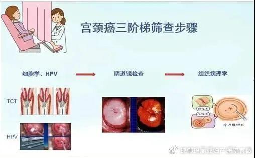 想預防宮頸癌光打hpv疫苗不夠別忘了做這件事