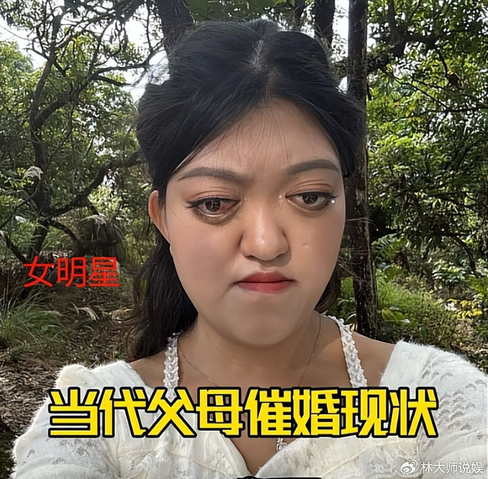 摆摆也不是网上唯一一个该病患者,另一个大网红女明星,也是克鲁宗综合