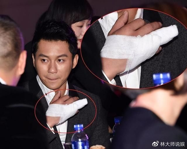 李晨奔跑吧脖子红印记否认新恋情_容易受伤的男人李晨_李晨综艺受伤敬业历史回顾