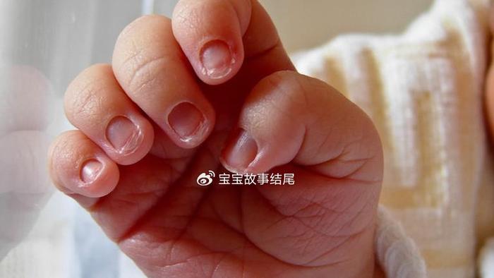 婴儿手上的表现，暗示着3个信号，尤其最后一个，是聪慧特征