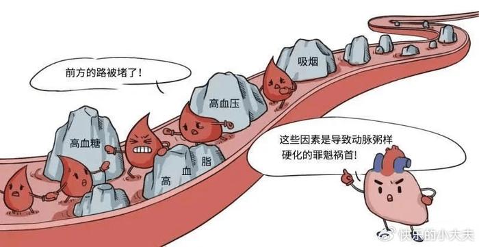 動脈粥樣硬化描述: 這是最常見的一種動脈硬化類型,以脂質和細胞擦趑