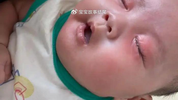婴儿初次户外，左眼失明，只因妈妈这一错误，要自检