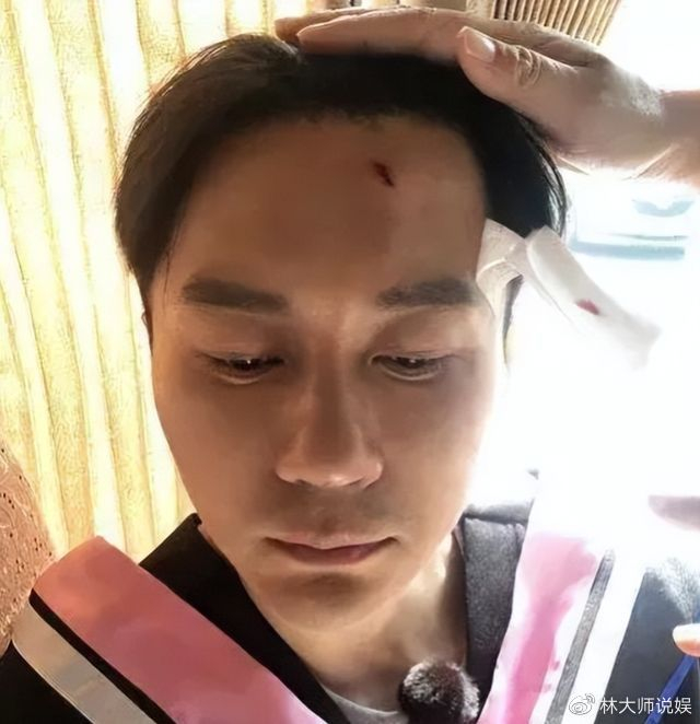 李晨奔跑吧脖子红印记否认新恋情_容易受伤的男人李晨_李晨综艺受伤敬业历史回顾