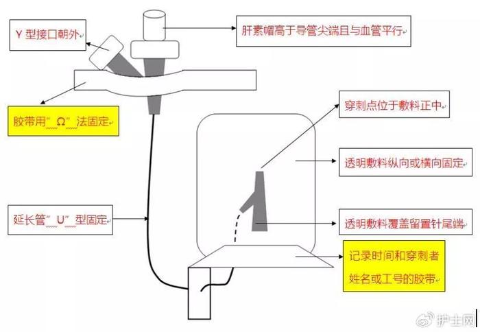 输血器构造及作用图解图片