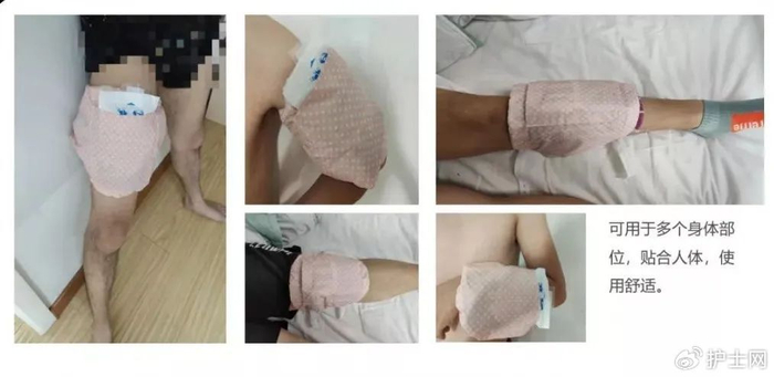 10个护理创新金点子解决临床各种护理问题