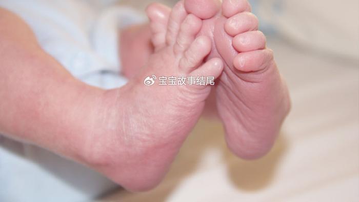 “寒从脚起”这句话有多坑人？3月龄宝宝出现真菌感染