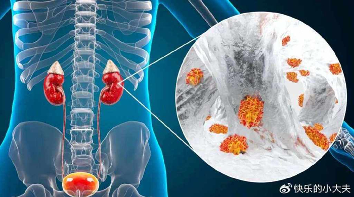 肾脏|尿毒症|肾功能_新浪新闻