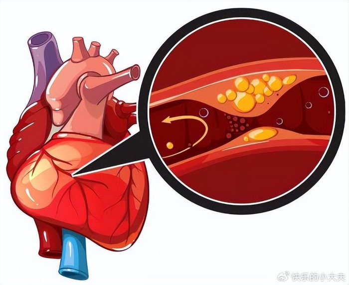 如何防范心脑血管疾病的"袭击"?远离9个元凶,守护心脑
