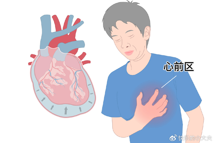 心绞痛是怎样一种感觉?
