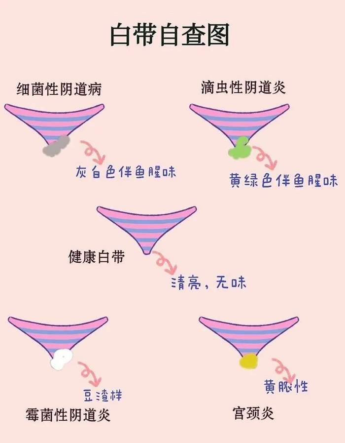 到底是正常还是异常?|白带异常|白带|霉菌性阴道炎_新浪新闻