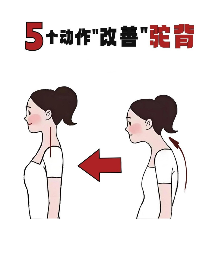5个瑜伽动作改善圆肩驼背