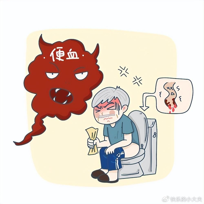 便血不要忽视医生提醒5个常见病因早诊断早治疗