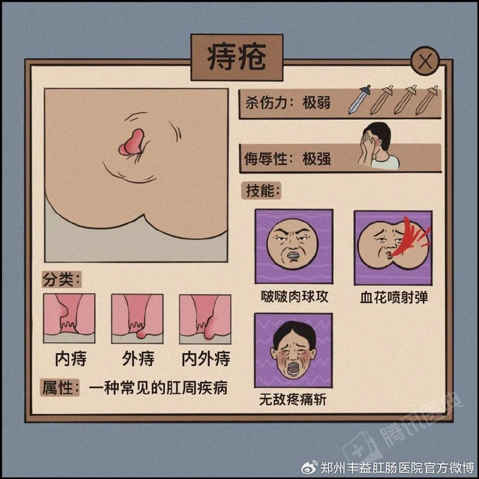 痔疮,便血反复发作怎么办?用对了方法,治疗其实很简单.