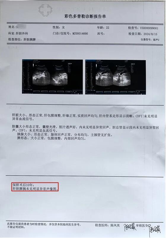 云南保胆分享:丽江女子10年前做了保胆手术,如今她有何感想