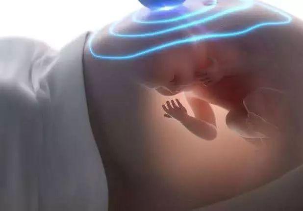 据说孕期的这些胎梦，是宝宝来报恩的？