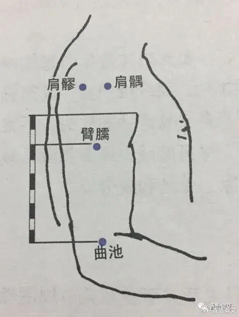 甲状腺结节艾灸位置图图片