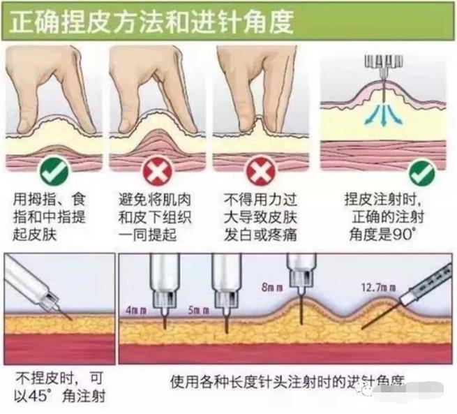 低分子肝素的使用及三種減輕疼痛的注射方法|藥液|出血|分子_新浪新聞