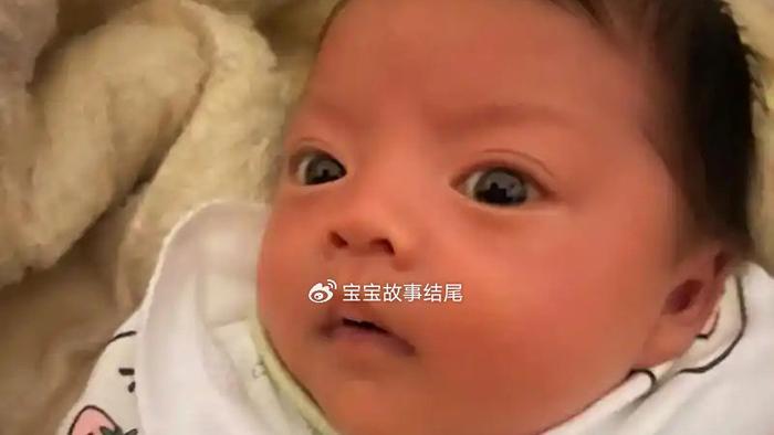 爸妈都是双眼皮，为何宝宝是单眼皮？早知道越好