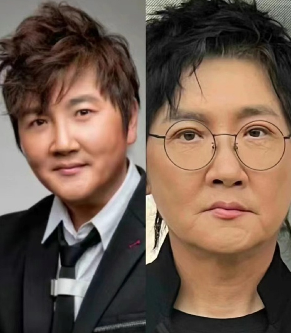 孙楠疑整容,很多网友都有这个感觉!