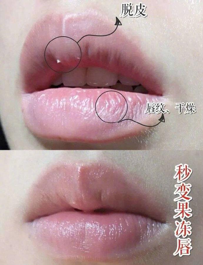 为什么擦了唇膏会起皮(为什么每天擦唇膏还是起皮)