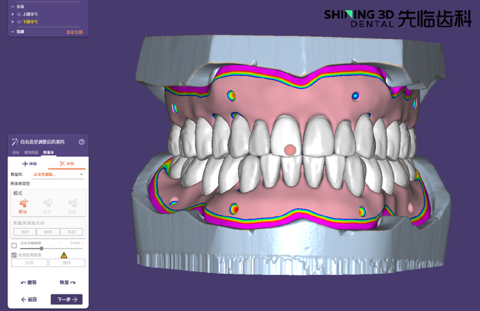 三维扫描仪 | 先临齿科技术干货之数字化放射导板制作流程|3D打印|数据|模型|基托|牙齿_新浪新闻