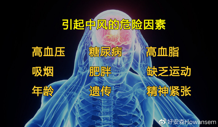 世界预防中风日 | 如何预防和识别中风?