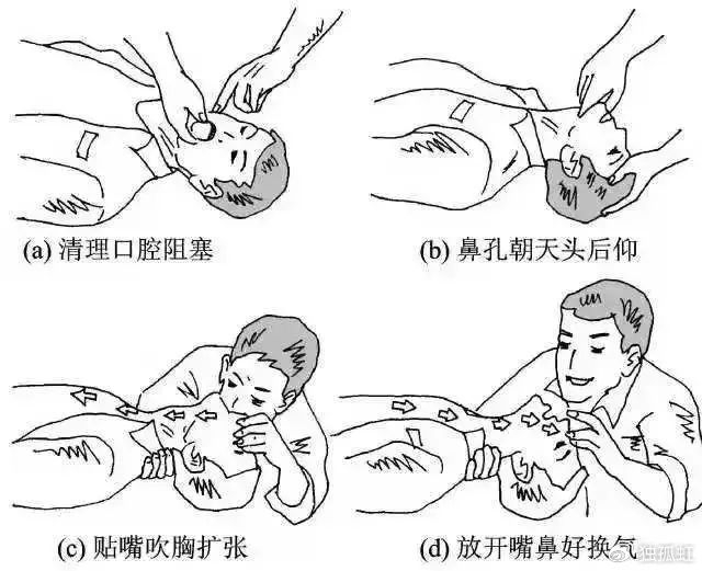 急救|鱼刺|胸骨_新浪新闻