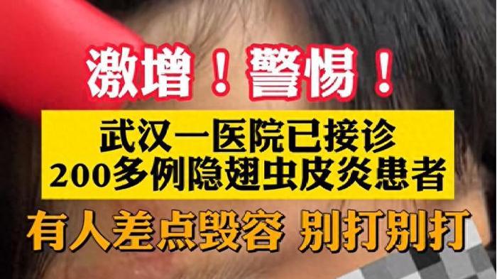 隐翅虫飞到孩子身上，妈妈“三步法”避免娃毁容，医生：做得对