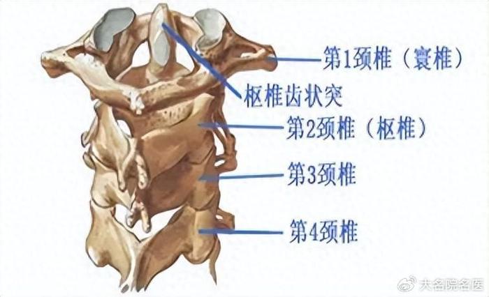 5岁男孩感冒后脖子持续疼痛,检查竟是寰枢关节半脱位!