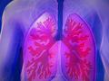 c-MET高表达肺癌新型ADC抗癌药：Emrelis获FDA加速批准上市