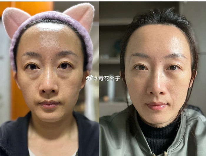 对比的俞楠泽,朱琳,刘莹,杨喆,宋春琼等 67好开心,跟随多年的眼袋