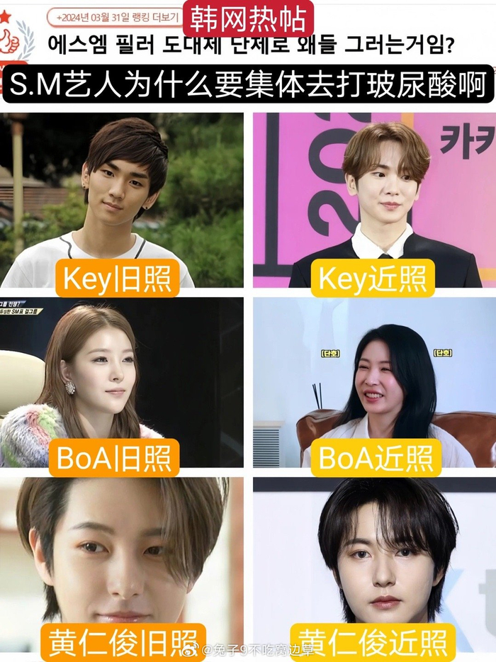 sm艺人们因为集体打玻尿酸被韩国人说了