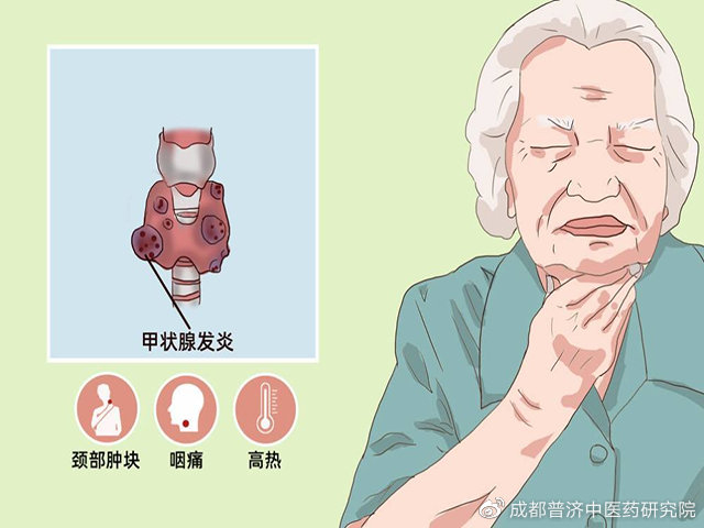 成都中医肿瘤医院丨成都普济中医肿瘤医院黄宏:四大不死癌症有哪些?