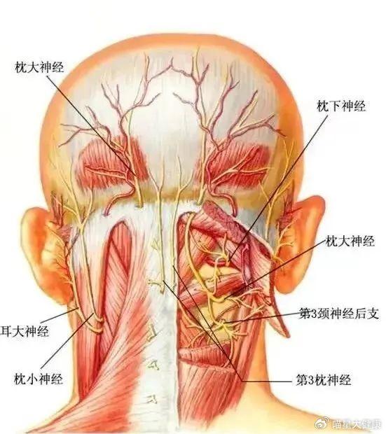 头痛之颈源性头痛