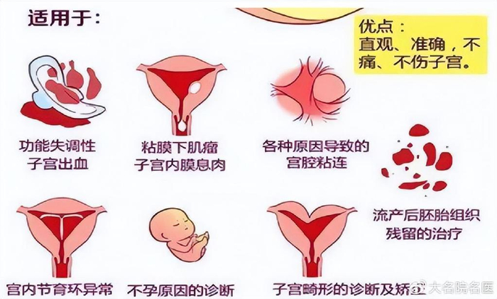 隐秘的子宫有疾病怎么看?宫腔镜来一探究竟