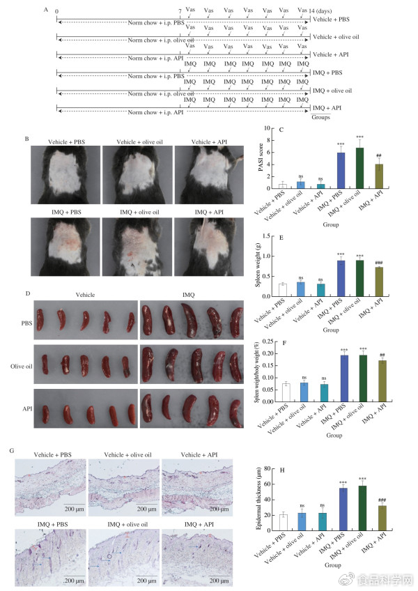 芹菜素对咪喹莫特诱导的小鼠银屑病的改善作用及其