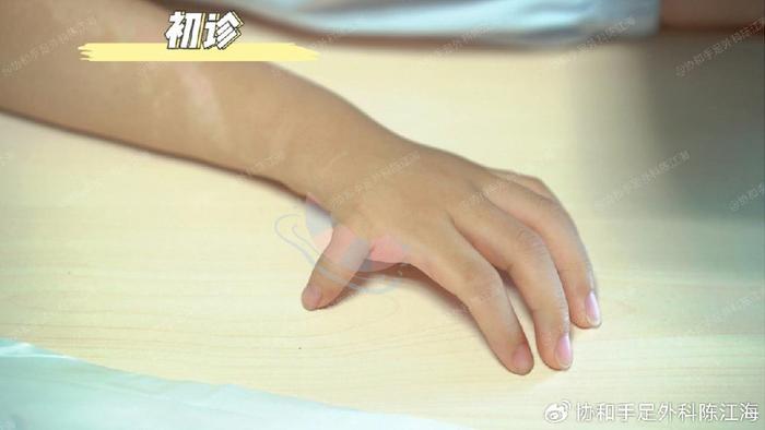 漂浮拇：成功保五指｜案例34《“虎妈”式教育，拇指如今能捏米粒》