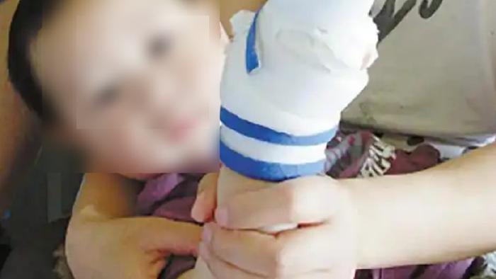 吃橘子右手被炸伤？孩子身边的“炸弹组合”常见又容易被忽视