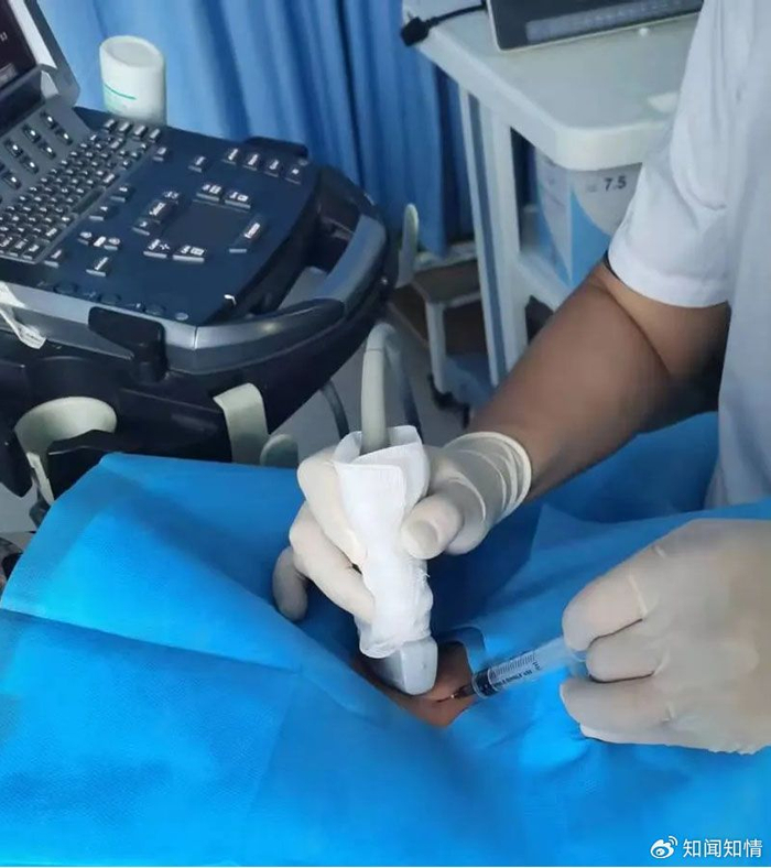 为患者实施超声引导细针穿刺泰安市中心医院甲状腺外科是泰安市首家集