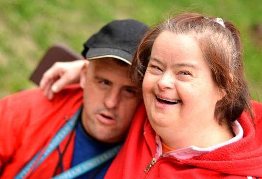 患有唐氏综合征的孩子通常会有特殊面容,身体和智力发育也会异常,尤其