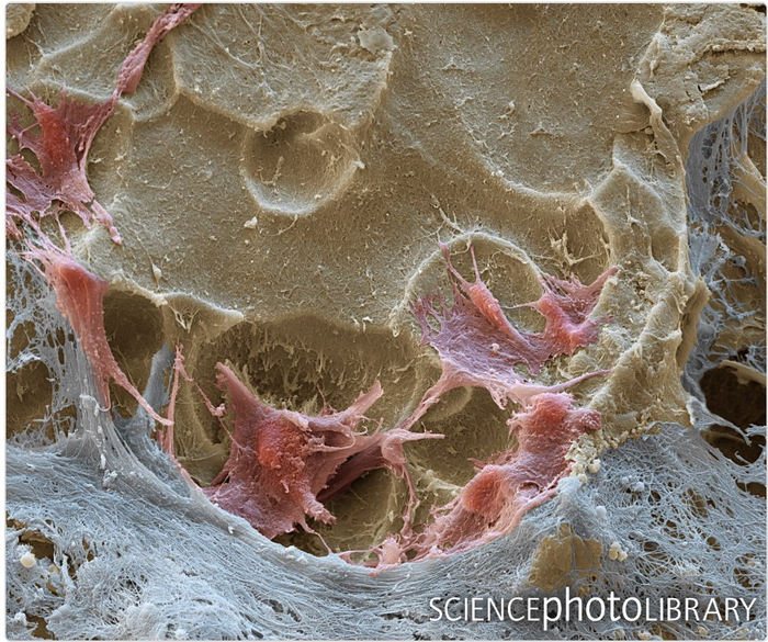 图像,显示骨表面上的破骨细胞